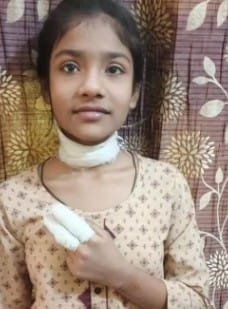 Chinese kite string slashed away an innocent child’s smile a girl riding on a bike suffered cuts to her neck and finger; the incident sparked outrage among the people IMAGE CREDIT TO POLICE