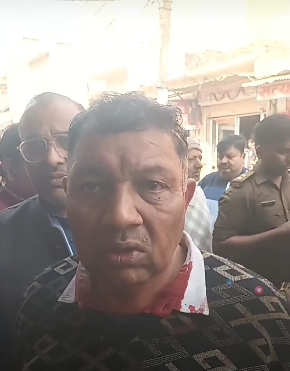 Daylight attack on a shop: Failed robbery attempt on a shoe trader, miscreants fled after injuring him on the head IMAGE CREDIT TO REPORTER