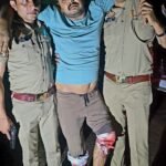 Loni police arrested a ₹50,000 reward accused in an encounter; he was shot in both legs. IMAGE CREDIT TO POLICE