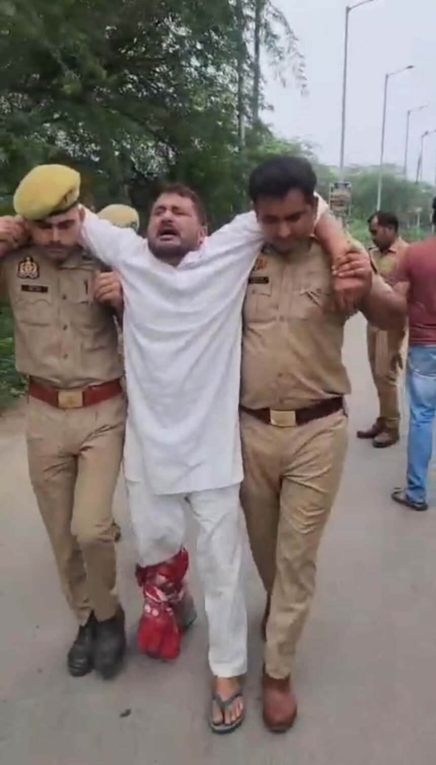 Loni Border Police Arrests Cow Slaughtering Accused in Encounter, Shot in the Leg | IMAGE CREDIT TO: POLICE