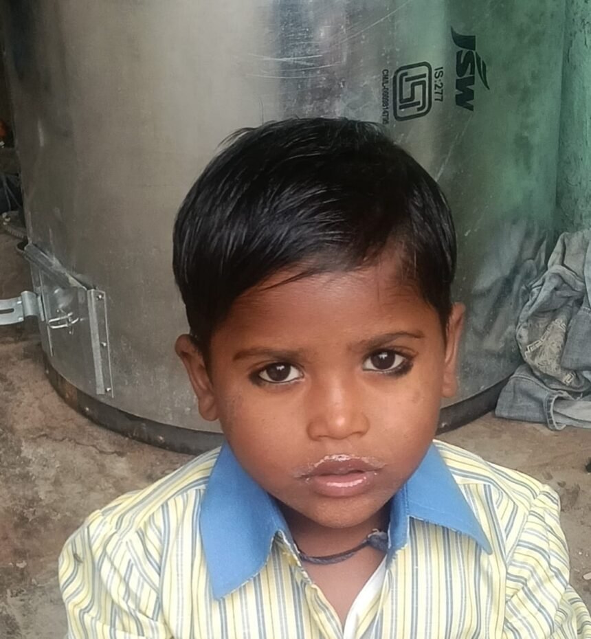 5-Year-Old Child Dies After Being Attacked by Stray Dogs; Panic Grips the Area — IMAGE CREDIT